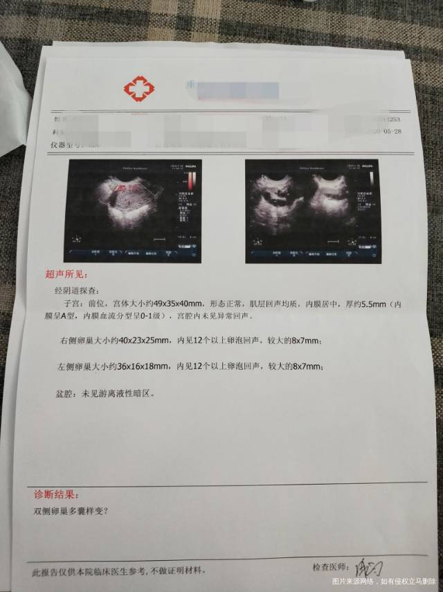 麻烦大夫帮忙看一下这种情况该怎么办