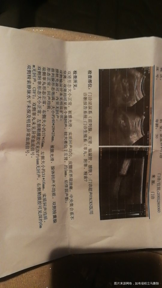 医生说我有点前列腺炎还有睾丸有滑液然后就是精