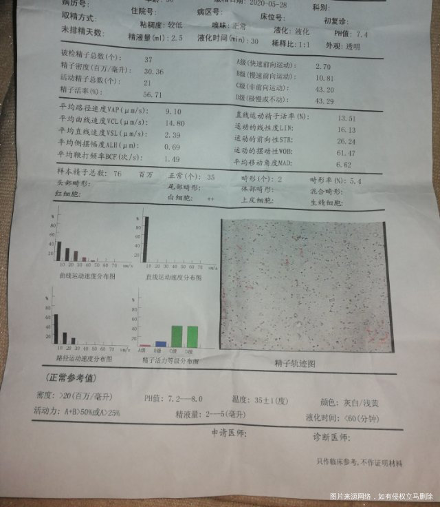 医生说我有点前列腺炎还有睾丸有滑液然后就是精