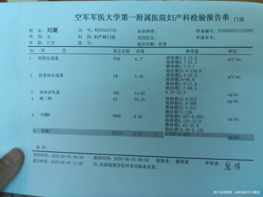 28女5月15做了个造影左侧输卵管复通右侧输