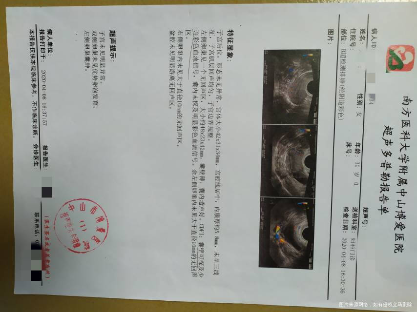 我今年30岁老多囊月经不正常近半年都是2个多