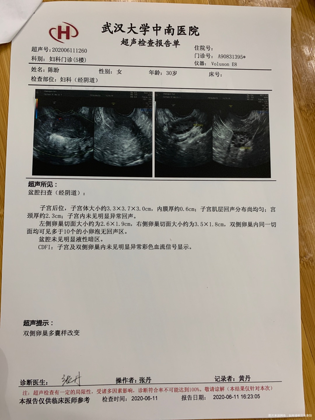 我想知道这个月有可能怀孕么