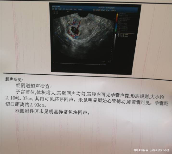 2015年5月剖腹产一个2016年6月药流一