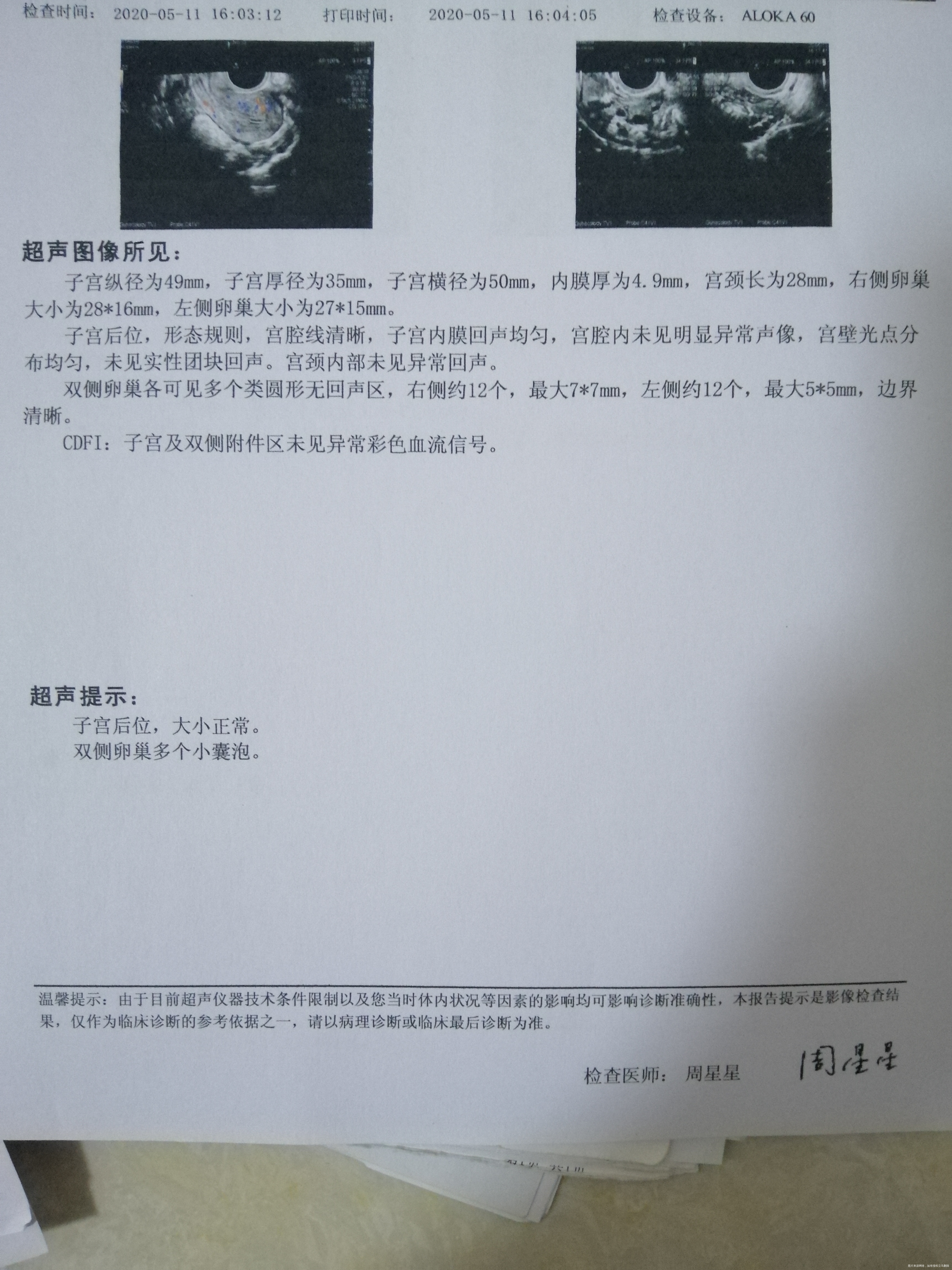 医生好本人27岁82斤5年前流产过一次现在备