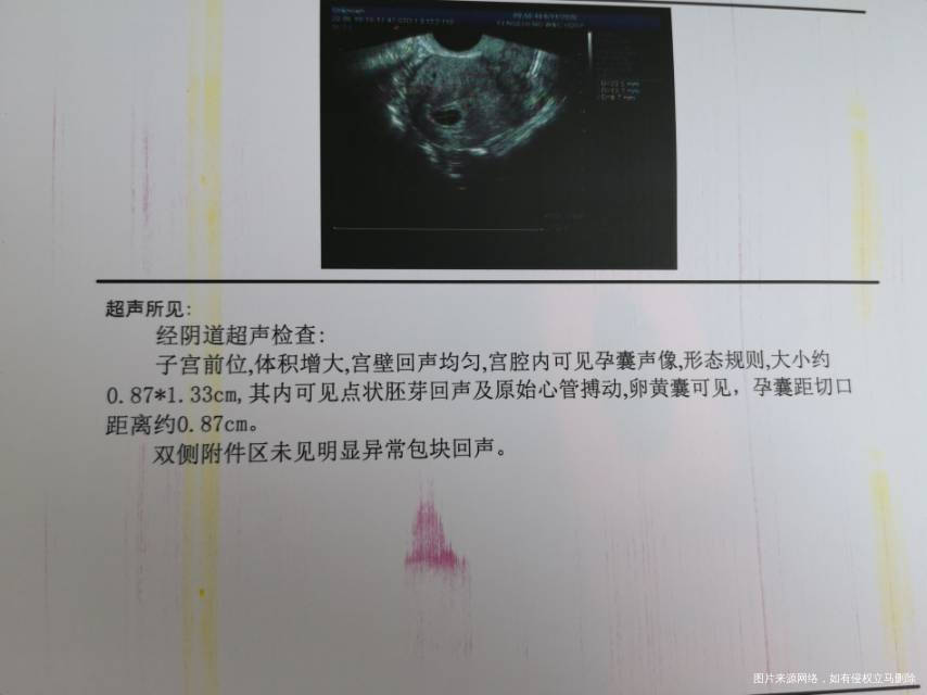 2015年5月剖腹产一个2016年6月药流一