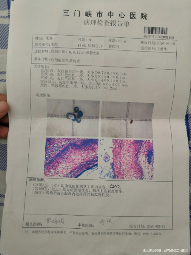 年龄28备孕1年半2020年3月份检查hpv