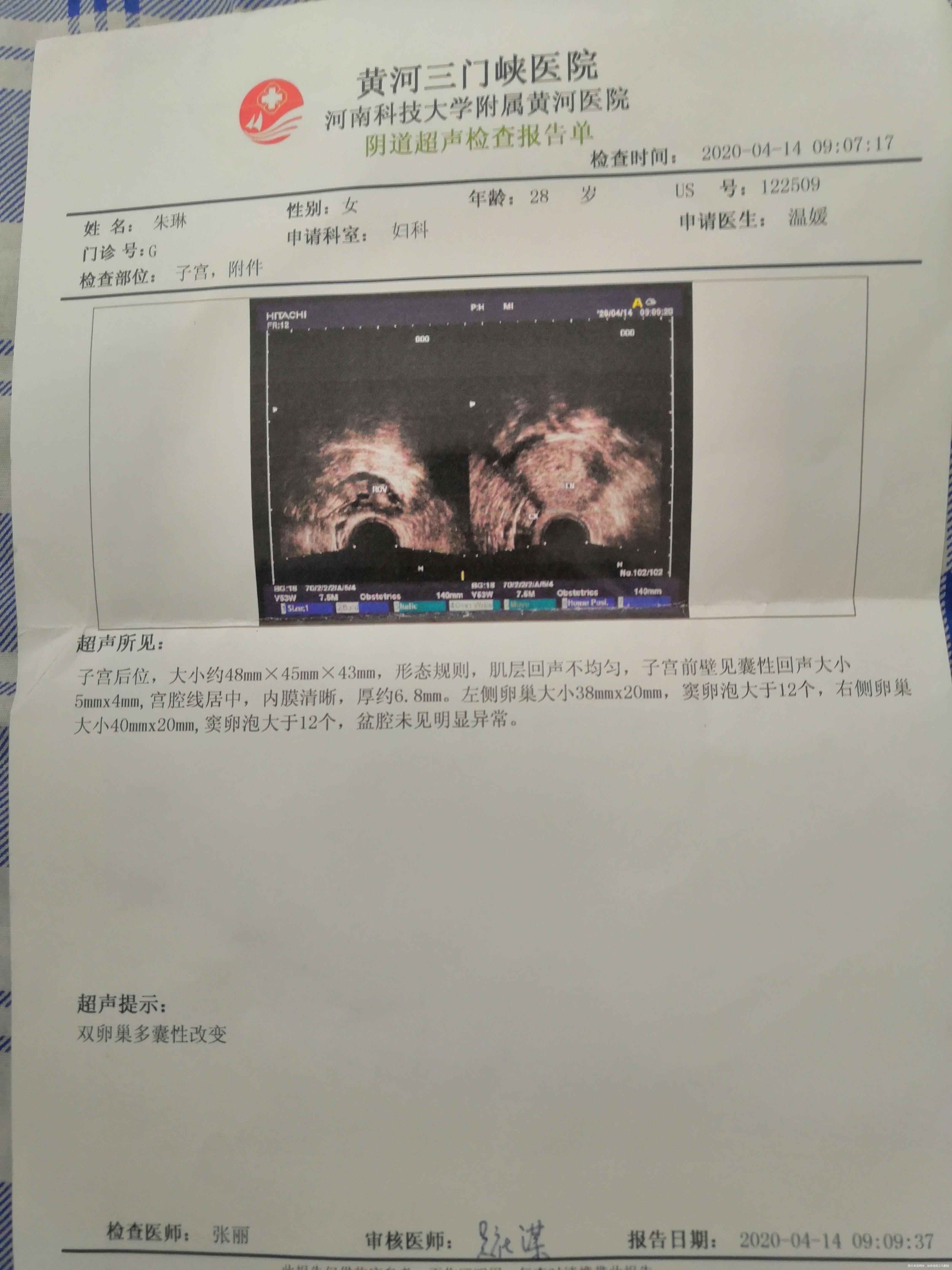 28岁140斤结婚一年没有备孕孕前检查出来双
