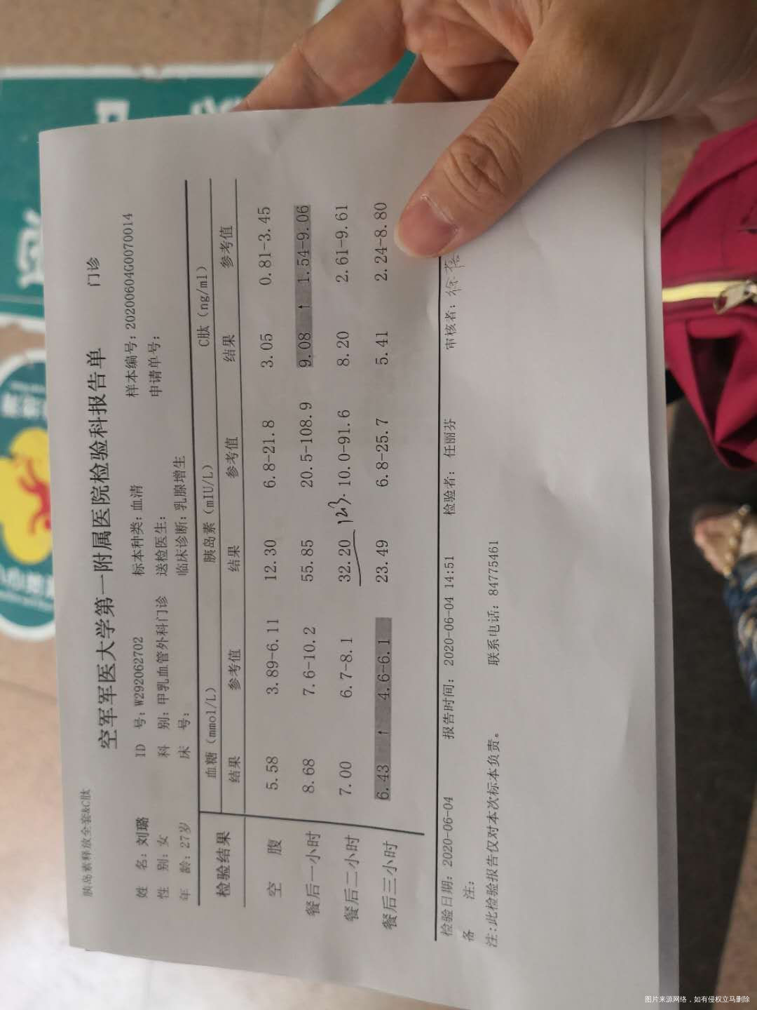 28女5月15做了个造影左侧输卵管复通右侧输