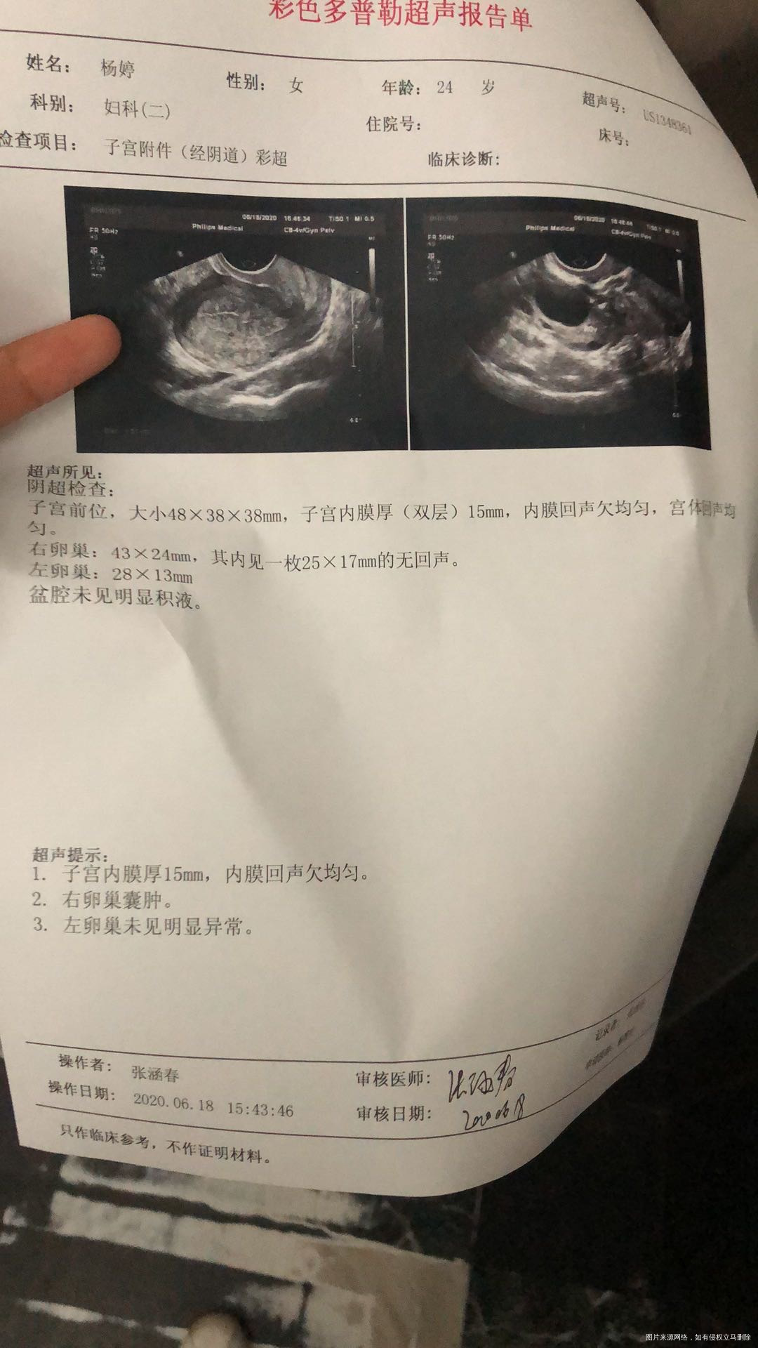 月经六月五号来的11号结束12开始又有褐色分