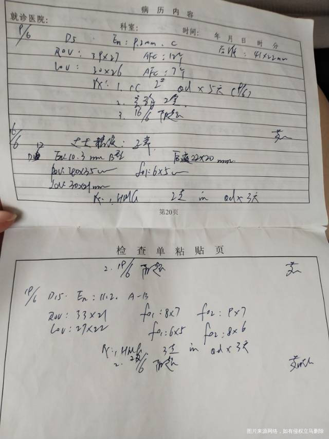 这个月是第四次促排了月经第5天去看了阴超看卵