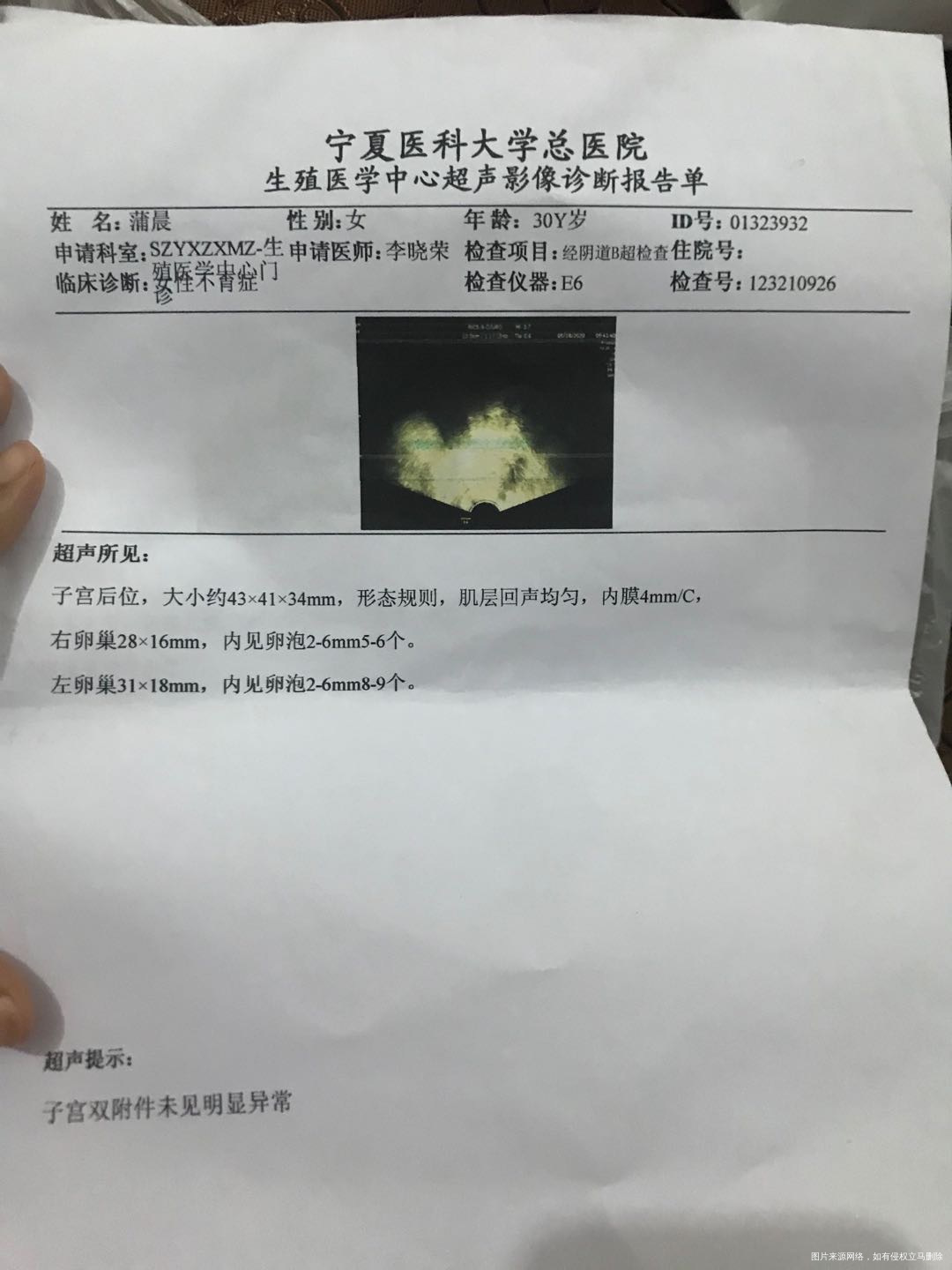 医生我5月20号打促排针然后没怀孕六月检查是