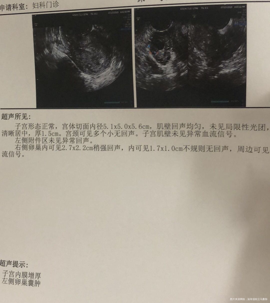 今年26岁从月经初潮开始月经就不正常后来检查