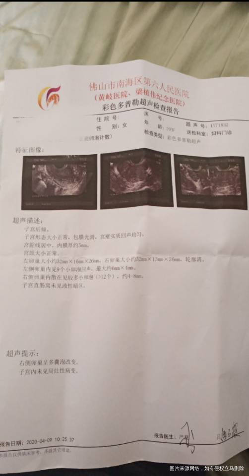 右侧多囊卵泡严重吗想促排