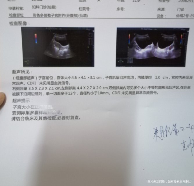 21岁平时月经少量不规律去年12月b超检查只