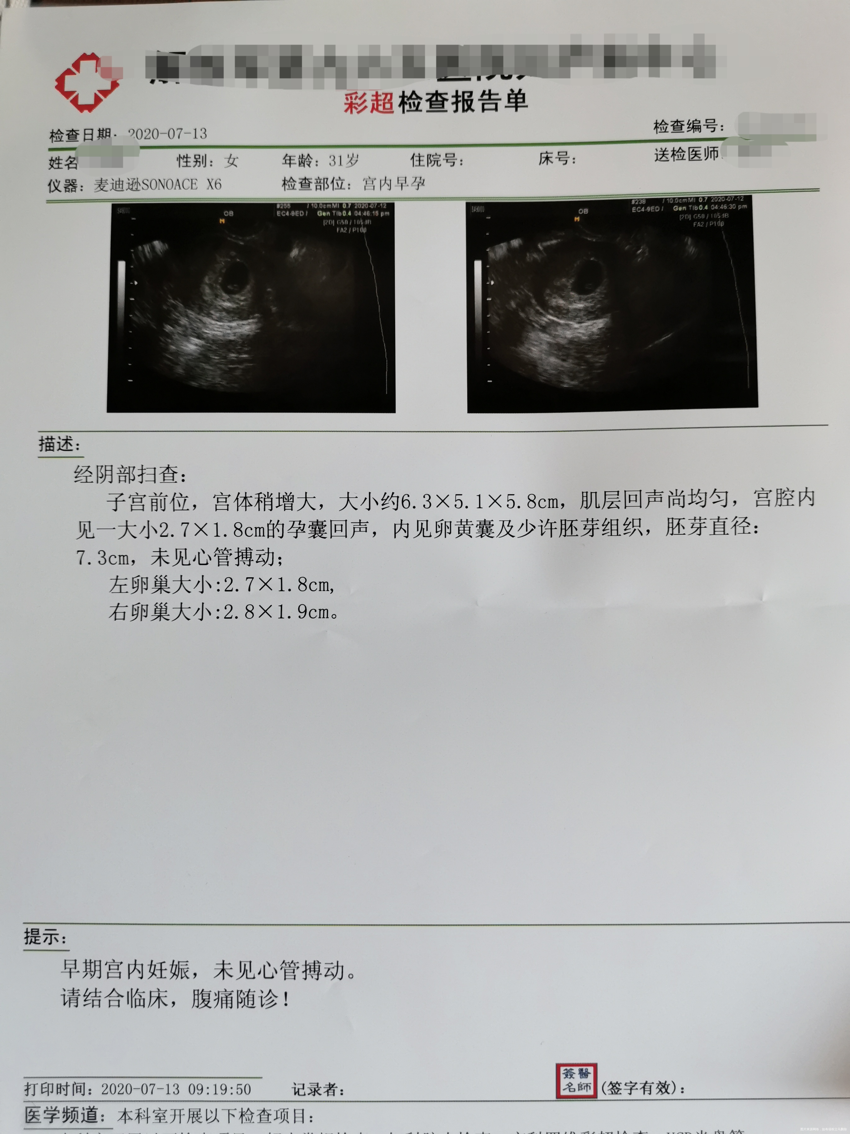 我是一名多囊5月10来的月经6月19日拿试纸