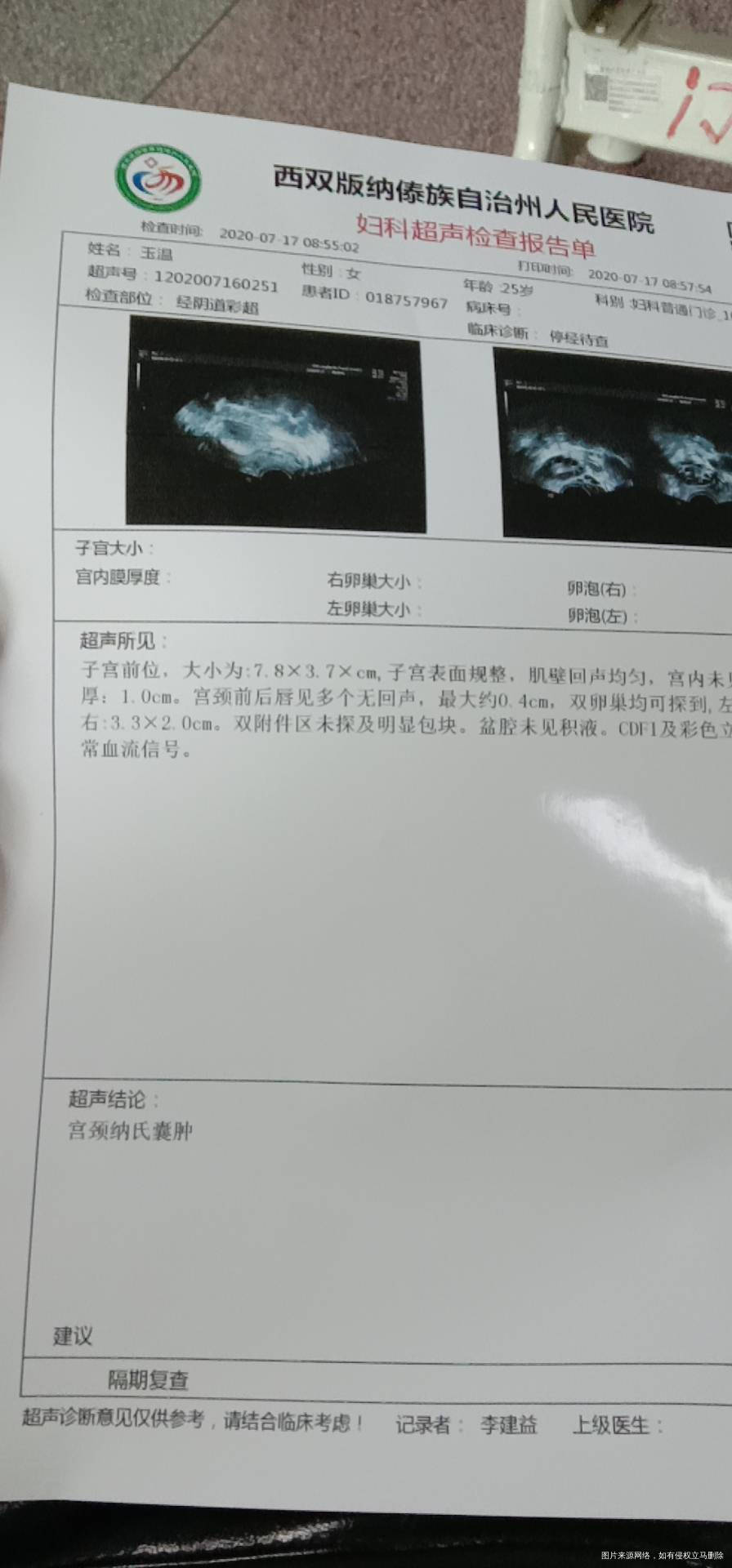 我今年26岁多囊好几年了吃了药就来月经不吃就