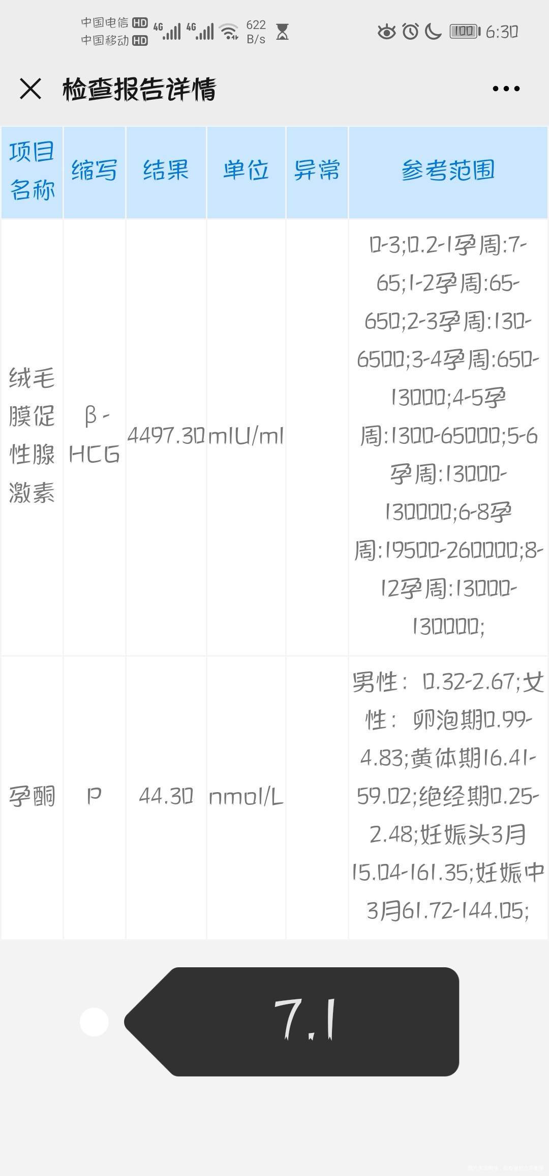 现在怀孕了下面是检查结果是不是胎儿发育不好呀