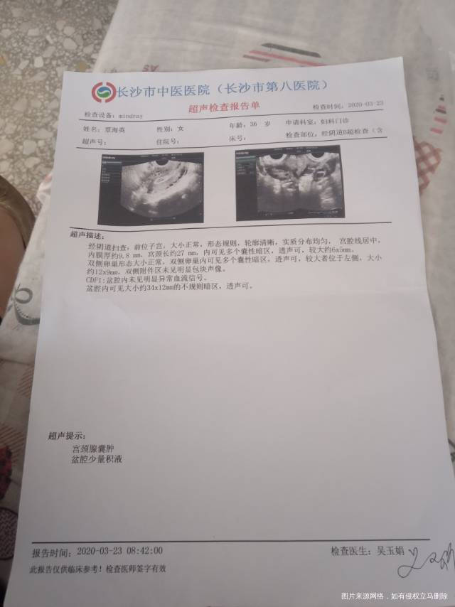 激素检查排卵B超有囊肿