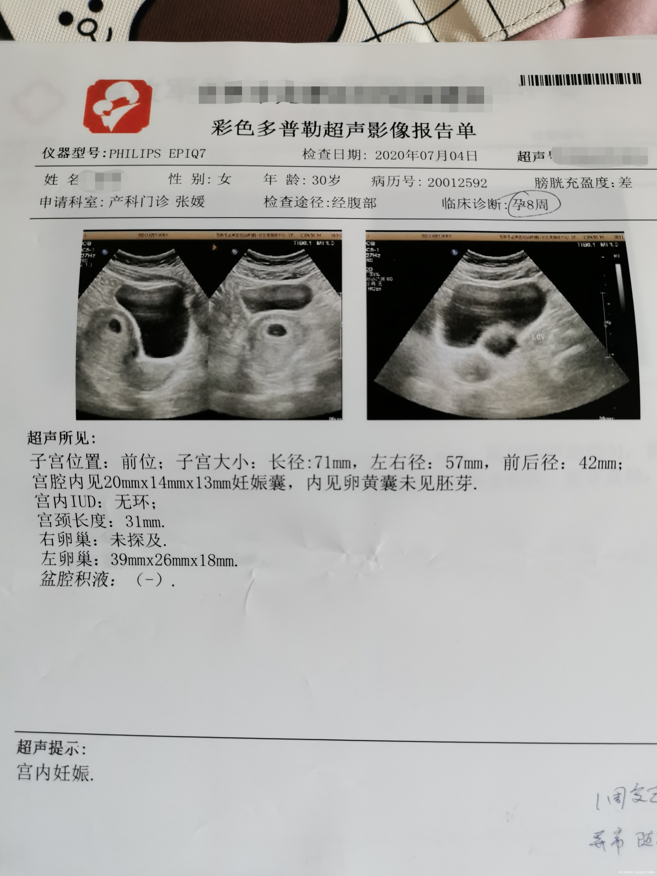 我是一名多囊5月10来的月经6月19日拿试纸