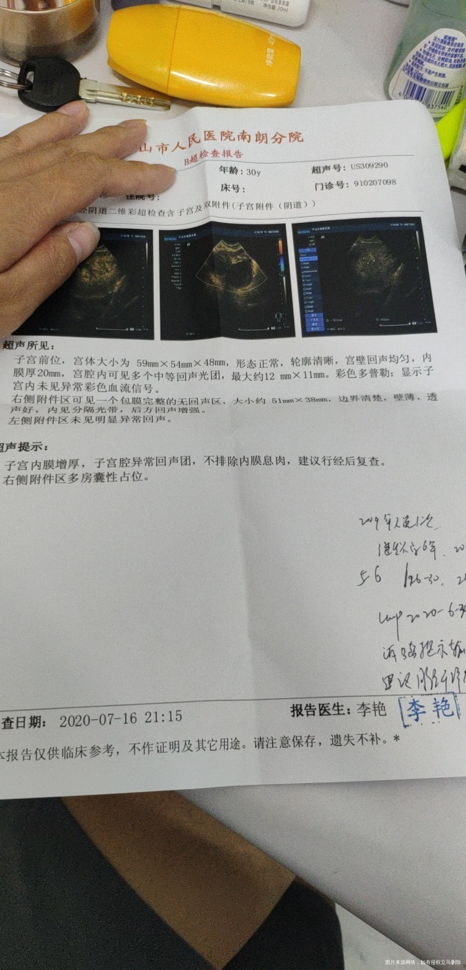 请问我这个激素水平是正常吗月经干净后第五天