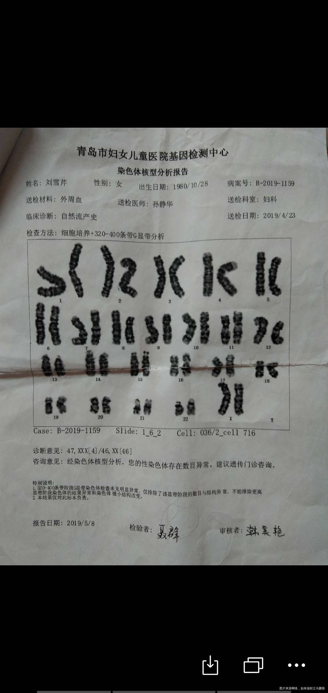 40染色体严重吗在青岛可以试管