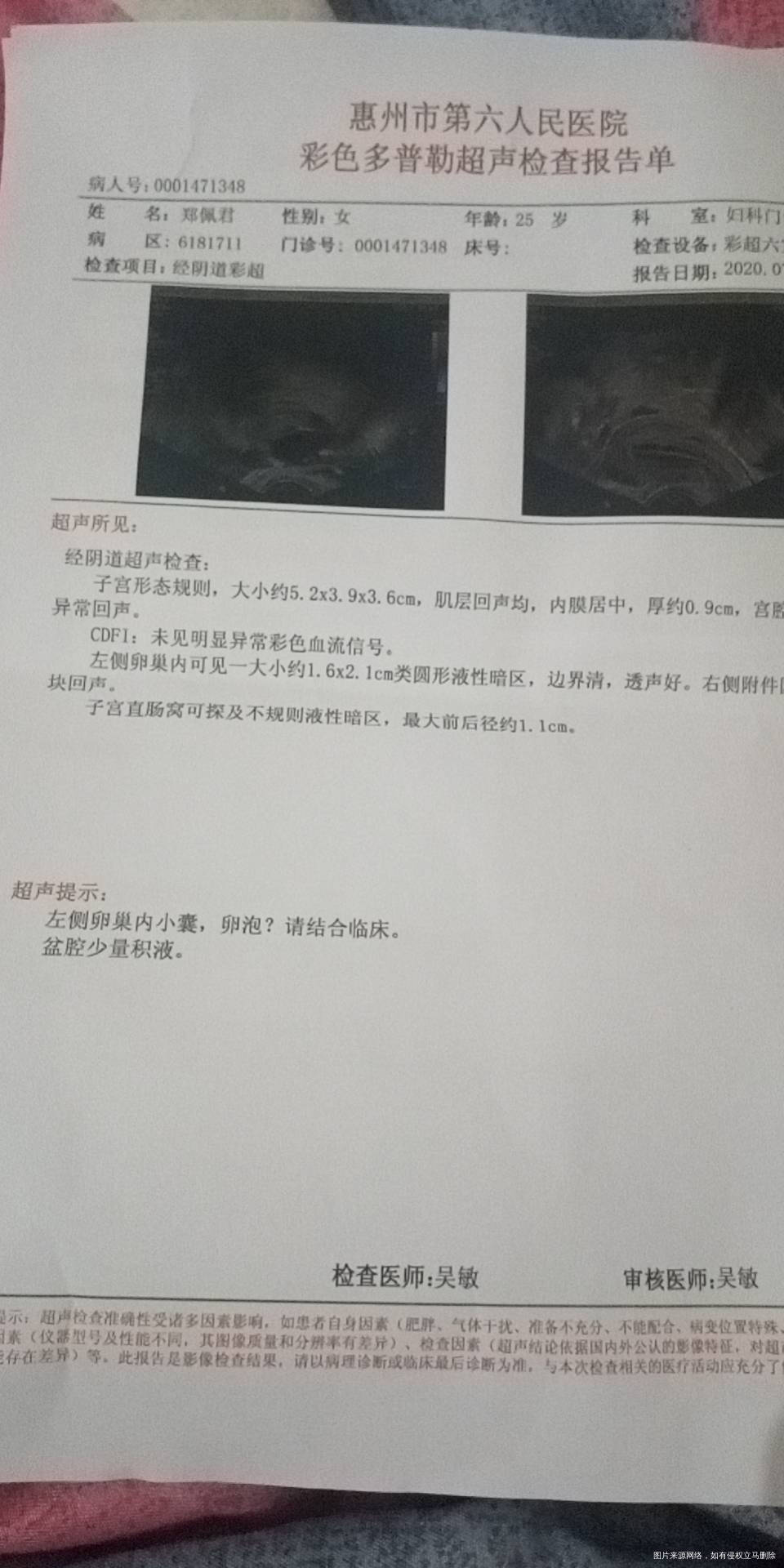 这是卵泡排卵期还是多囊卵巢