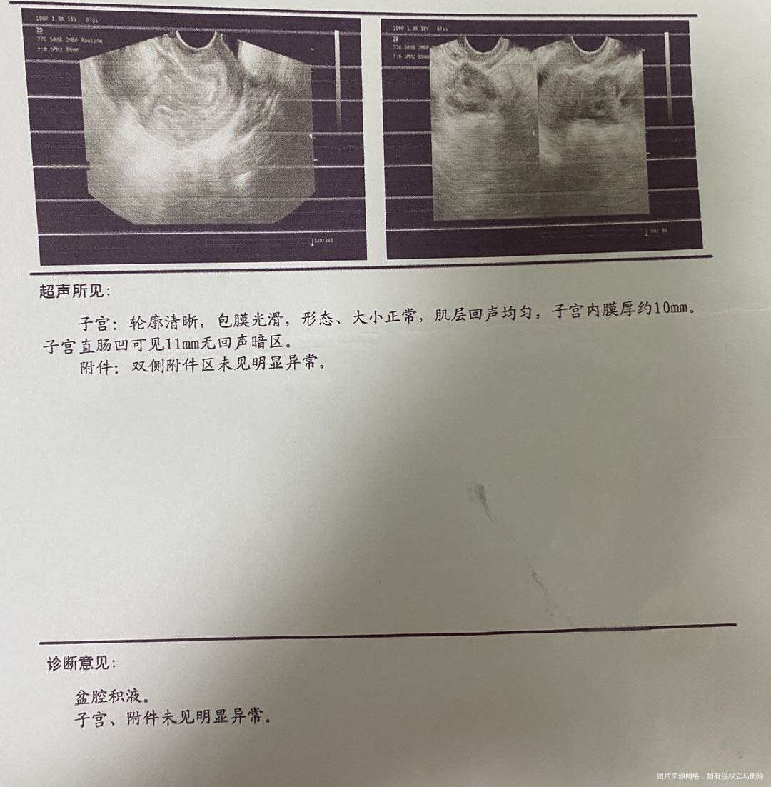 28备孕4个月例假不规律3060天为主最近一
