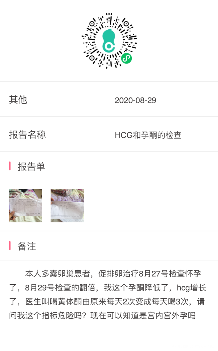 本人多囊卵巢患者促排卵治疗8月27号检查怀孕