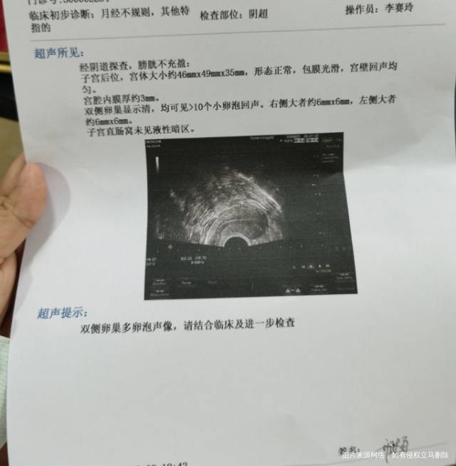 吃了一个月的优思明激素降下来了但是内膜对比6