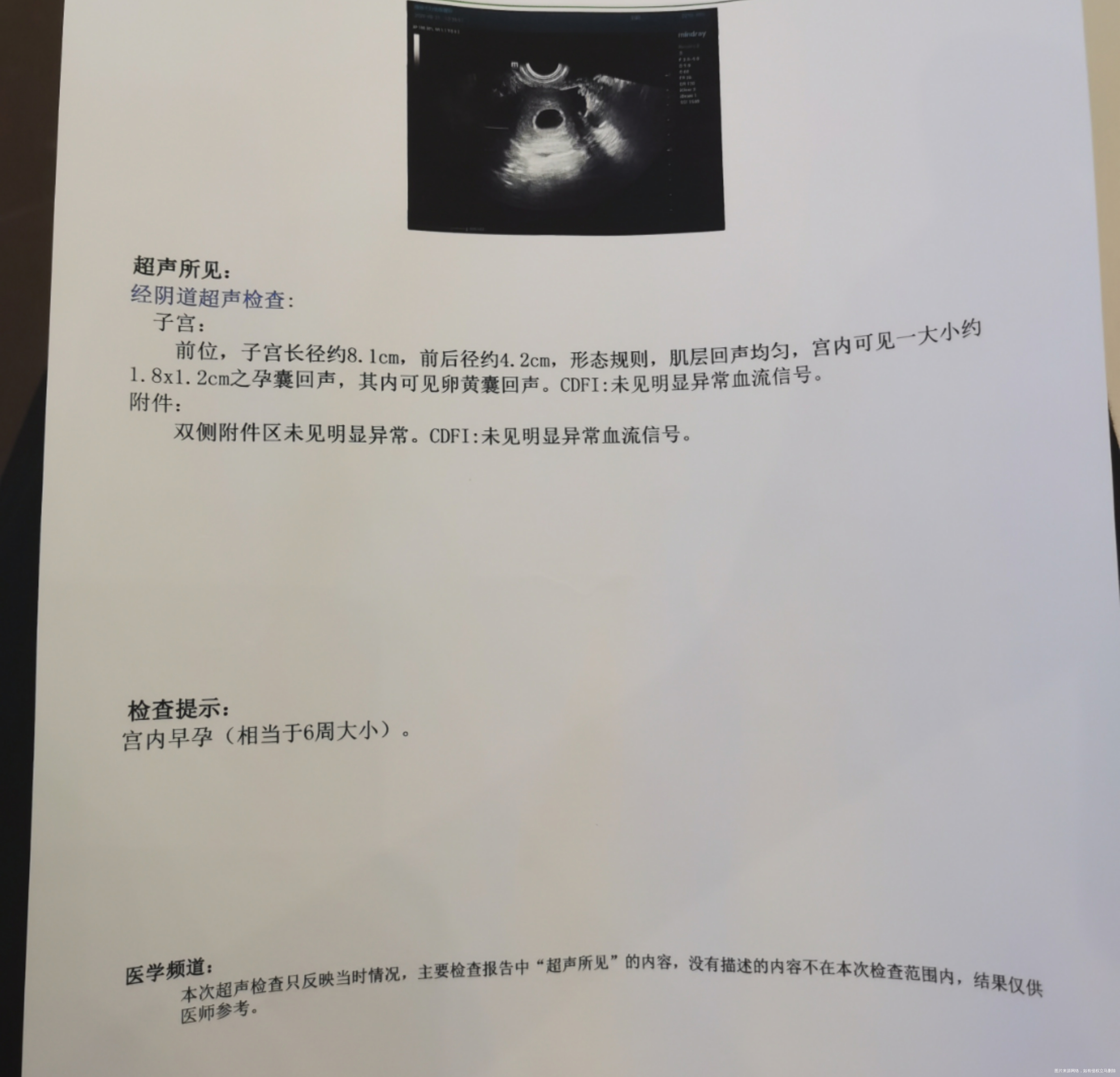 各位医生好我是已经吃优思明+二甲双胍调理三个