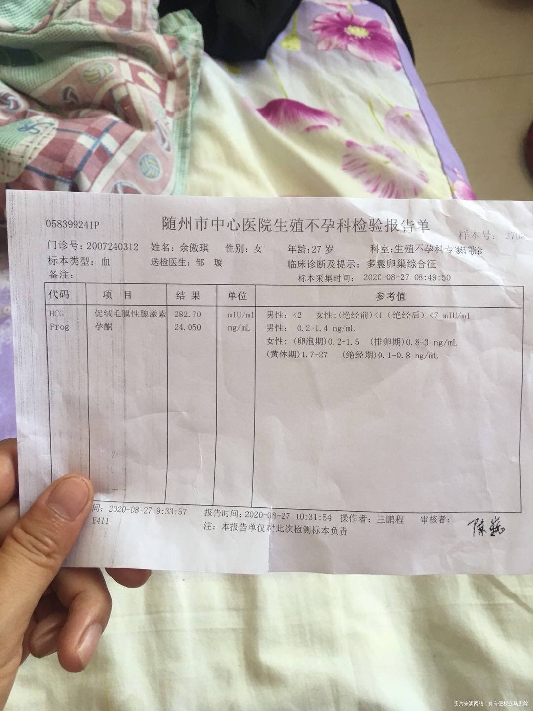 本人多囊卵巢患者促排卵治疗8月27号检查怀孕