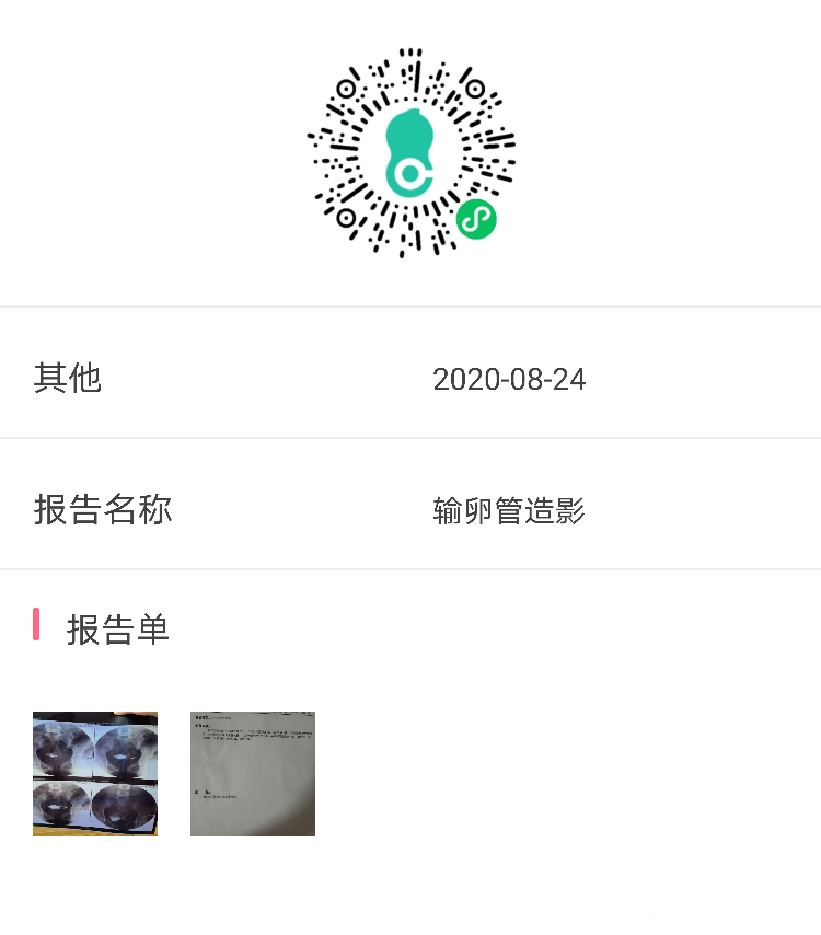 您好最近做了甲状腺性激素六项卵巢功能都正常之