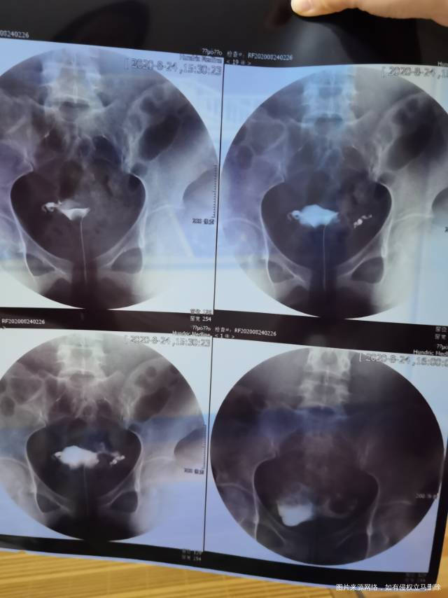 您好最近做了甲状腺性激素六项卵巢功能都正常之