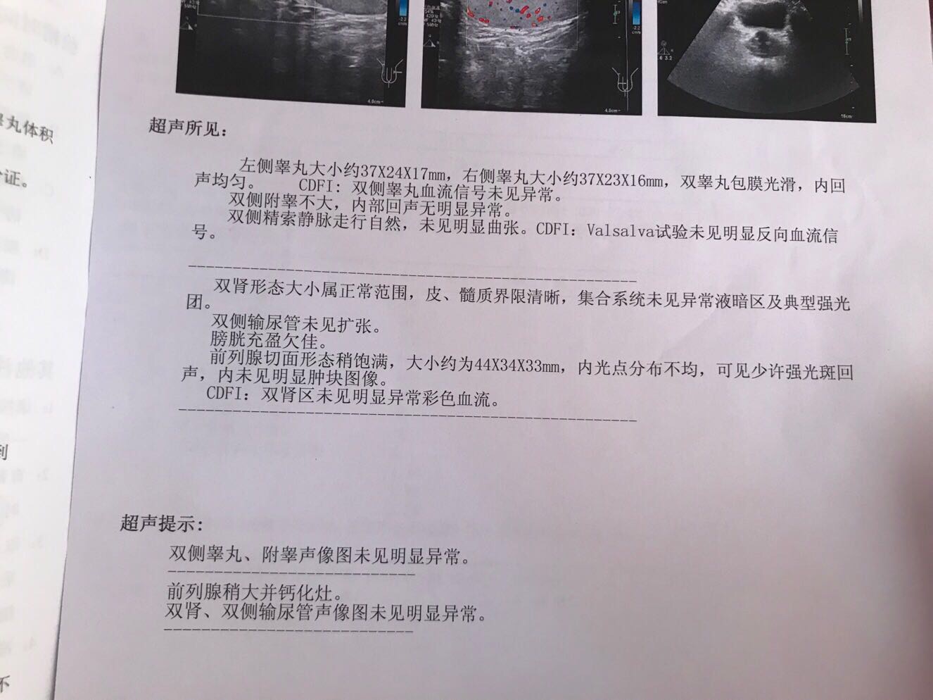 请问精子碎片率高如何解决目前有在吃善存维生素