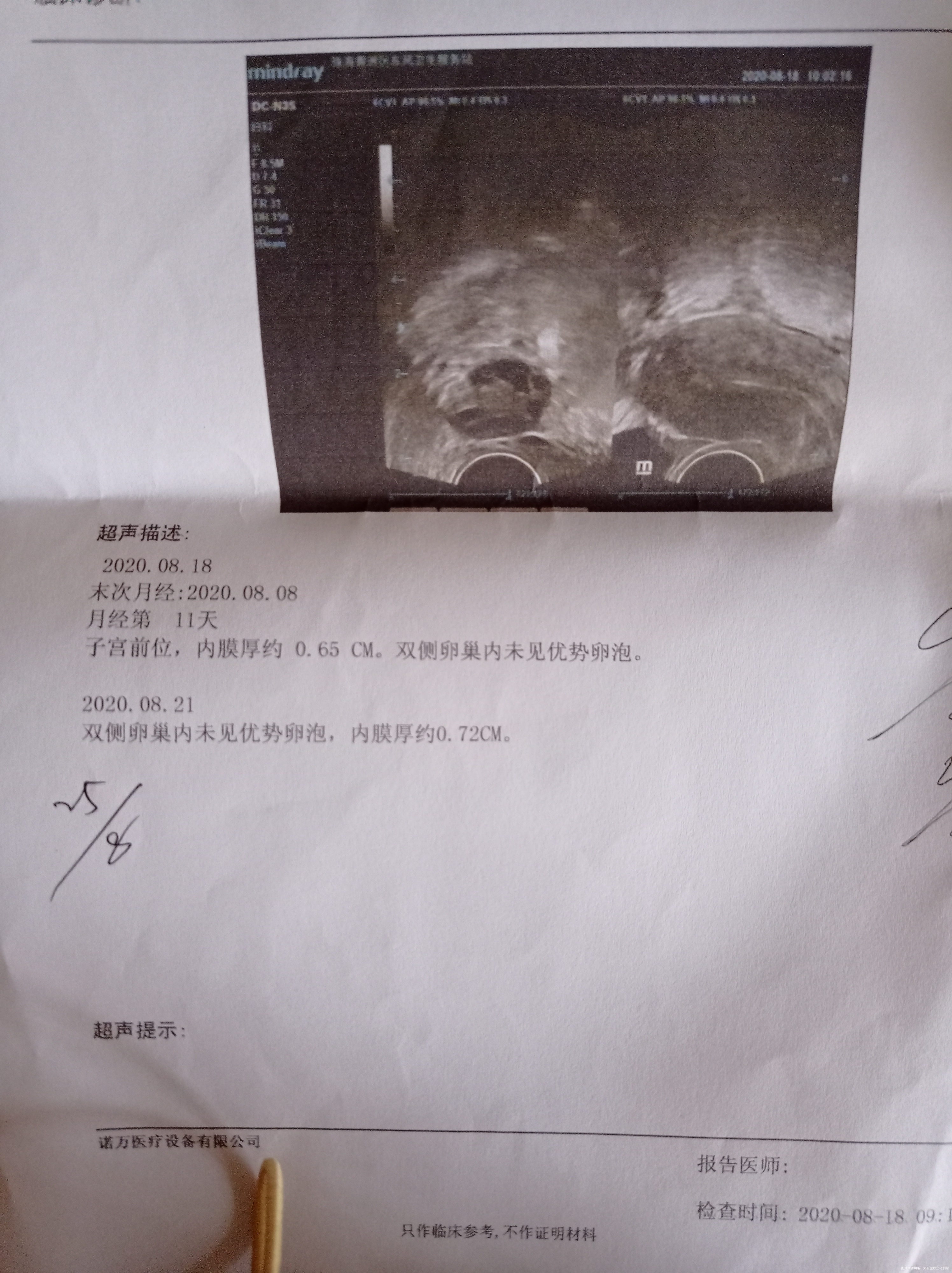 不来月经卵泡不长大这个月吃了很多促排中药卵泡