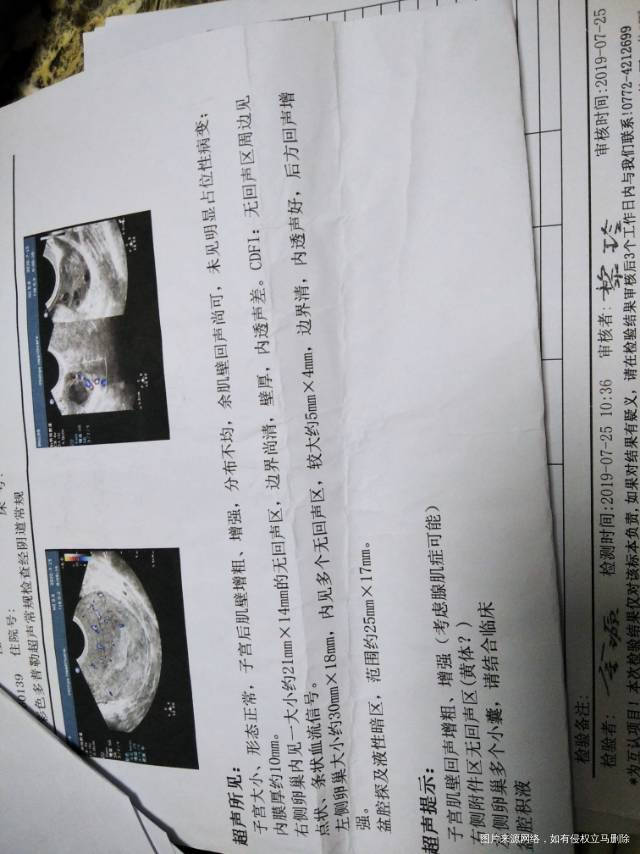 6月1号最后一次月经7月15号去医院做了检查