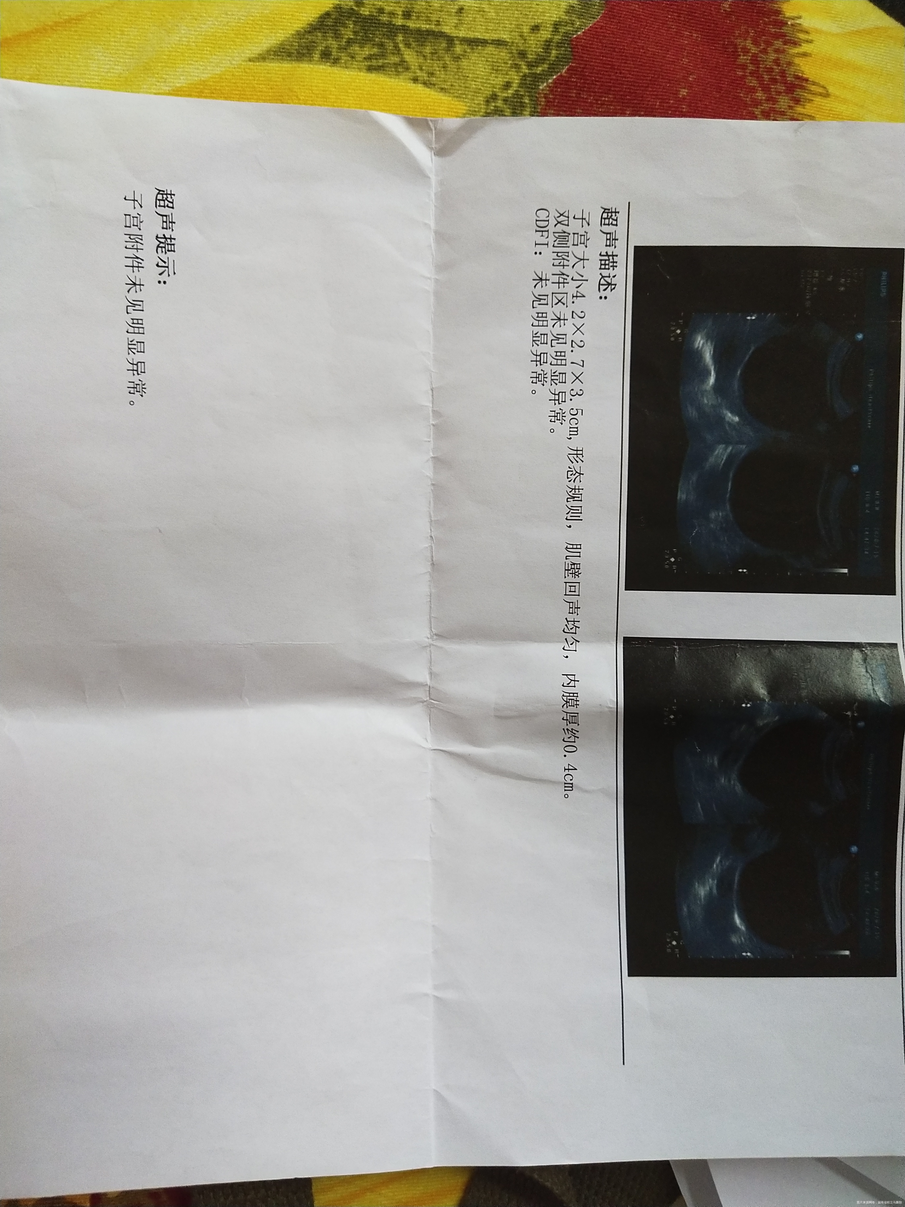 我今年22岁月经一直不规律这次又是快两个月没