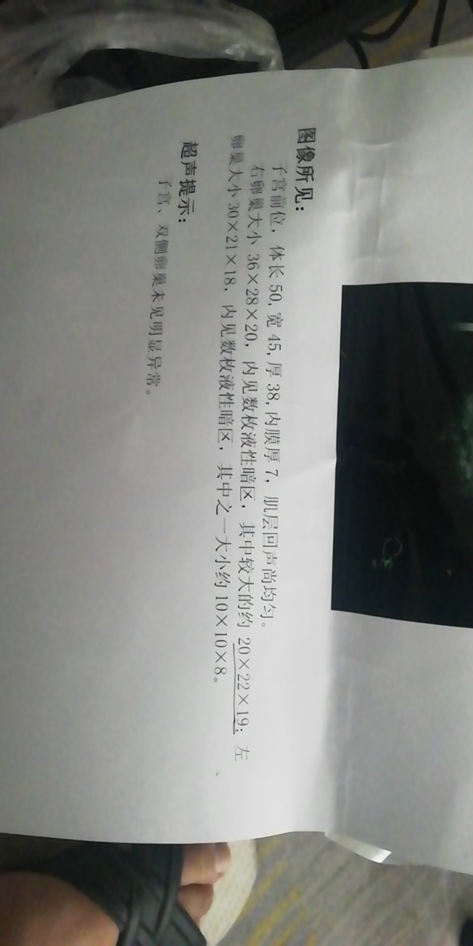 我是今年429空囊做的清宫手术之后5月没来月