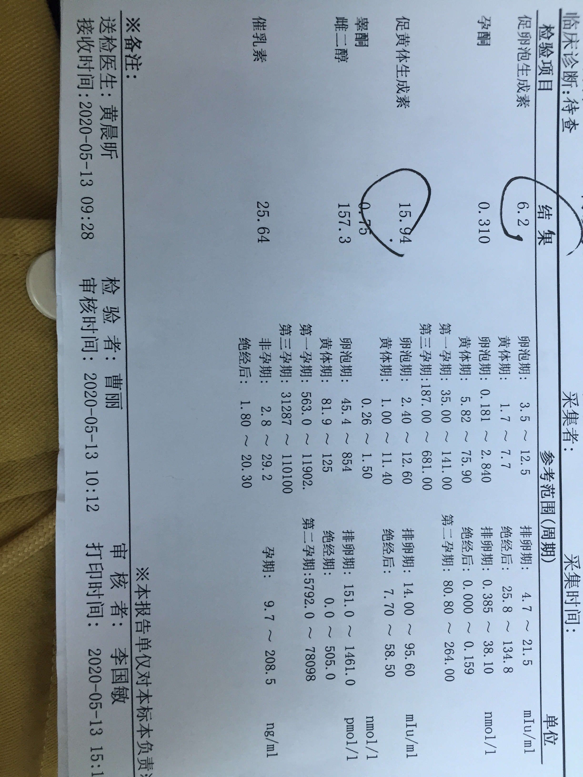 29岁备孕一年多发现每次去医院检查排卵情况要