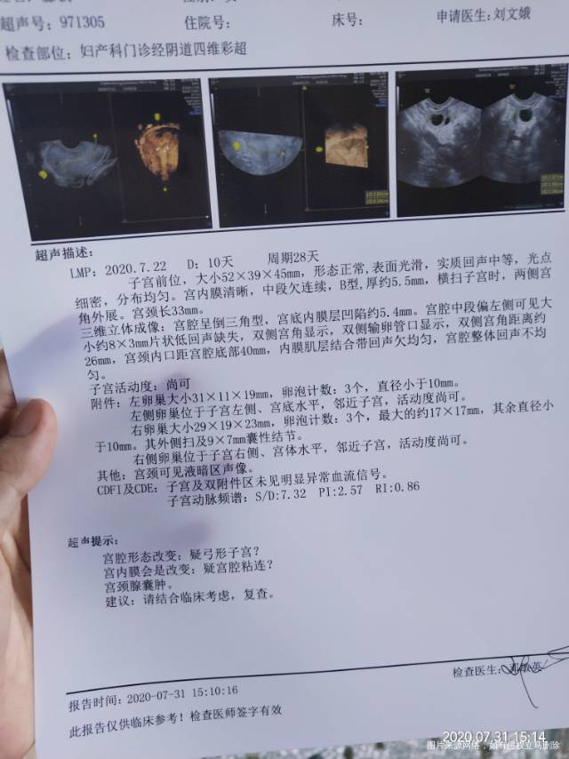 我这个情况该怎么备孕