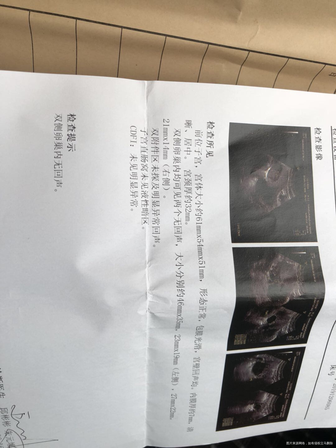 36岁输软管有积水有的医院建议做宫腹腔镜手术