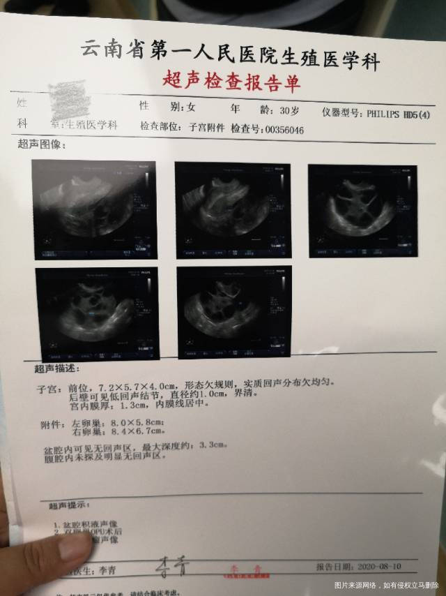 医生你好我是准备做试管的6月23日打的降调7