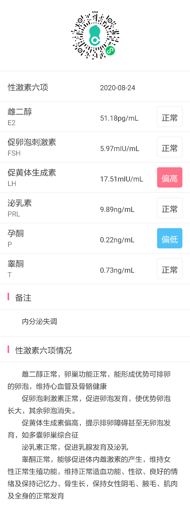 医生您好促黄体生成素高就是多囊卵巢综合征吗