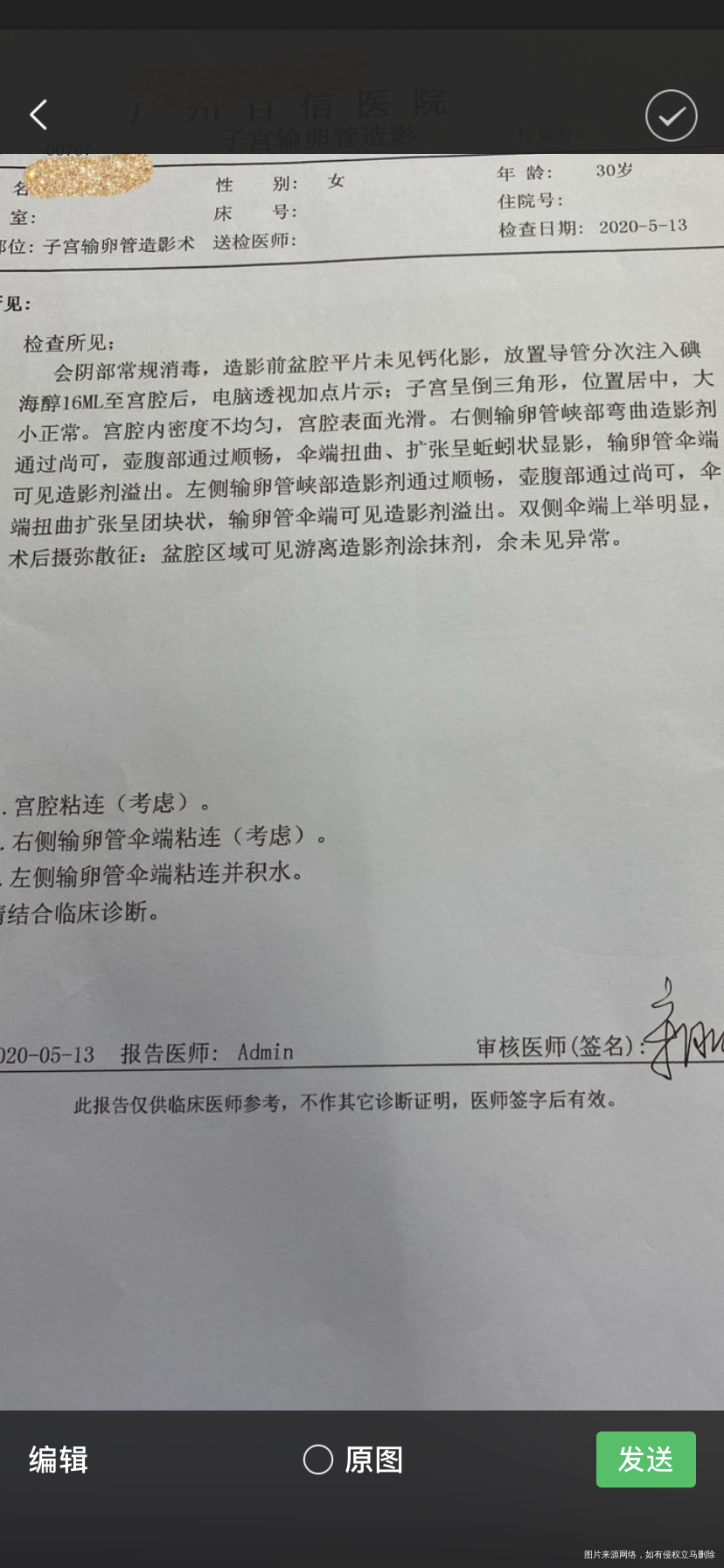 这种情况要手术吗做手术能自然怀孕吗