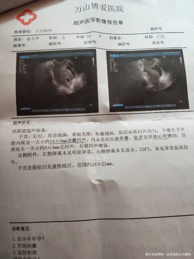 35天的hcg是13537天的hcg是318