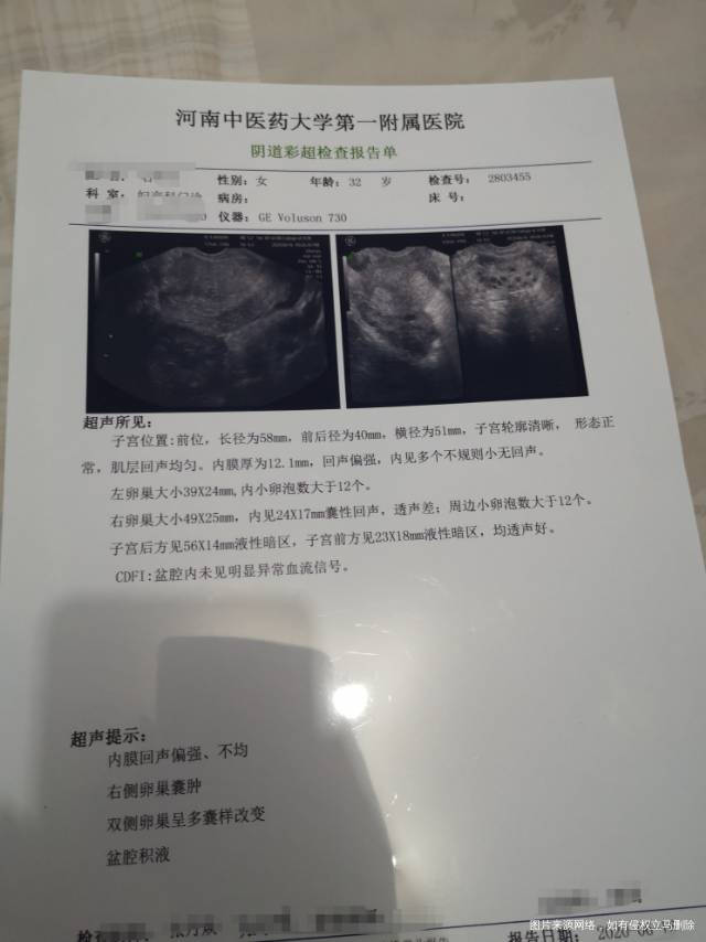 6月份做过阴道彩超显示多囊样改变还有囊肿例假