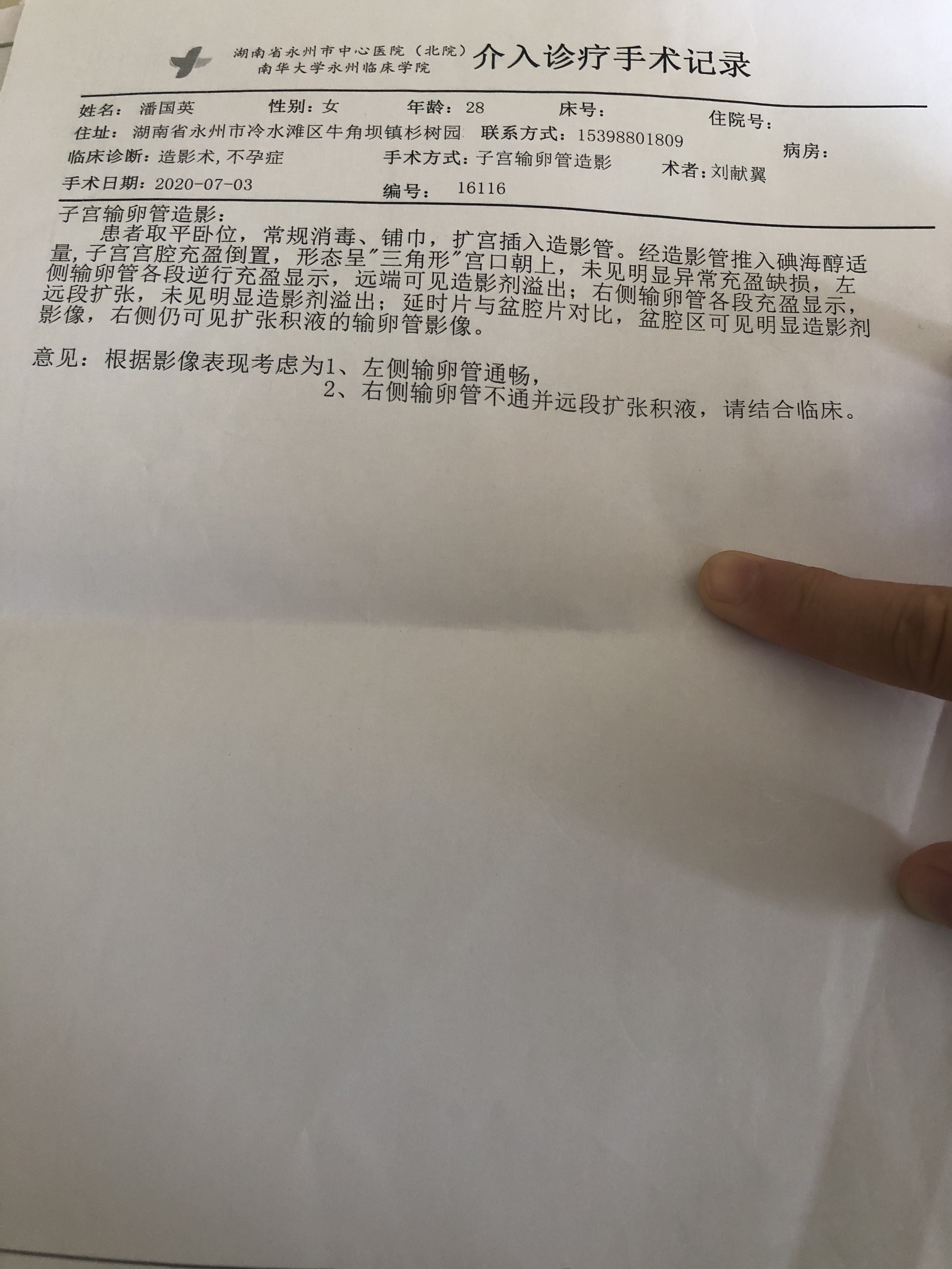 2月份做了宫外孕手术最近做了输卵管造影备孕的