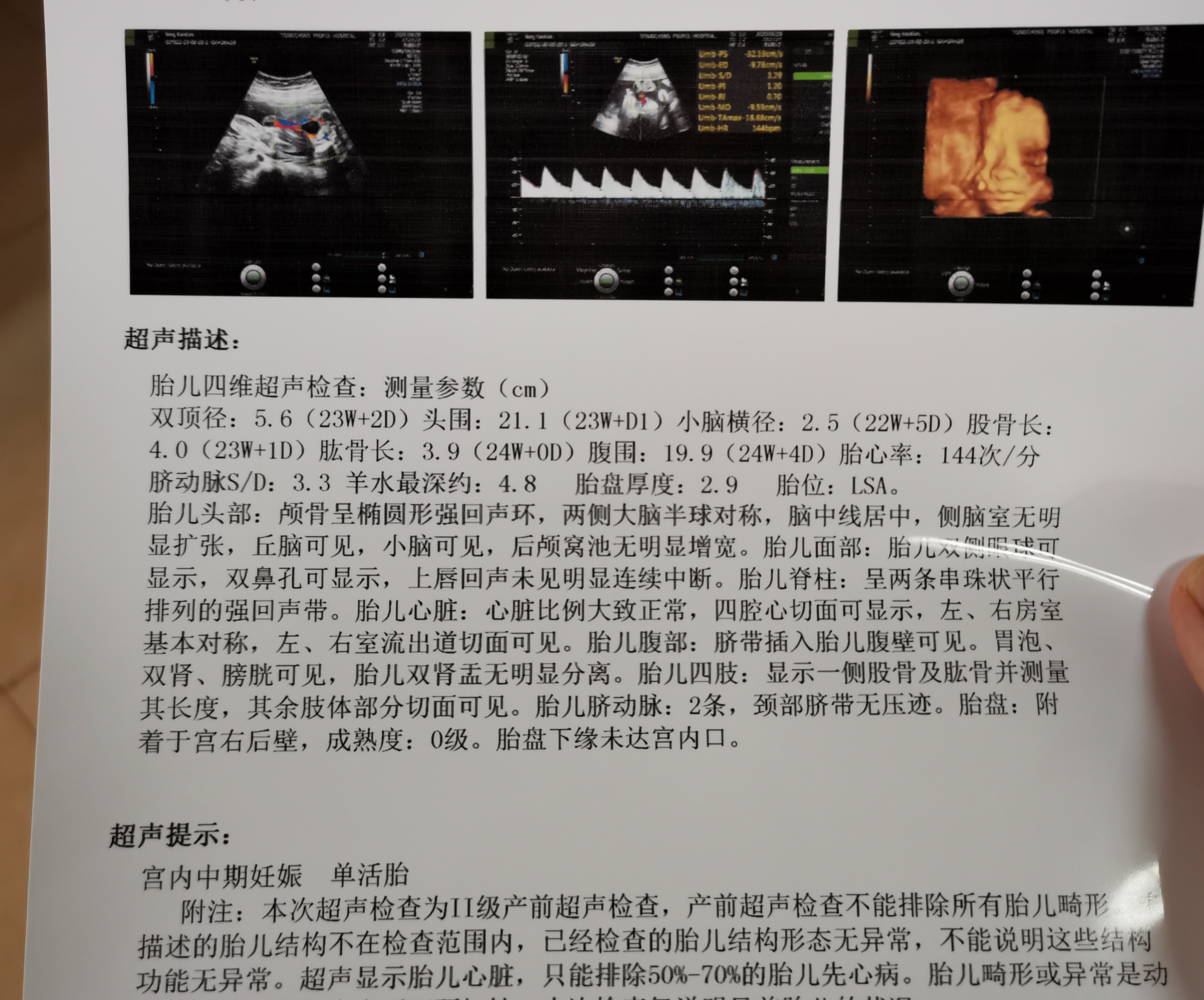 医生您好我是纵隔子宫24周今天刚做的四维这个