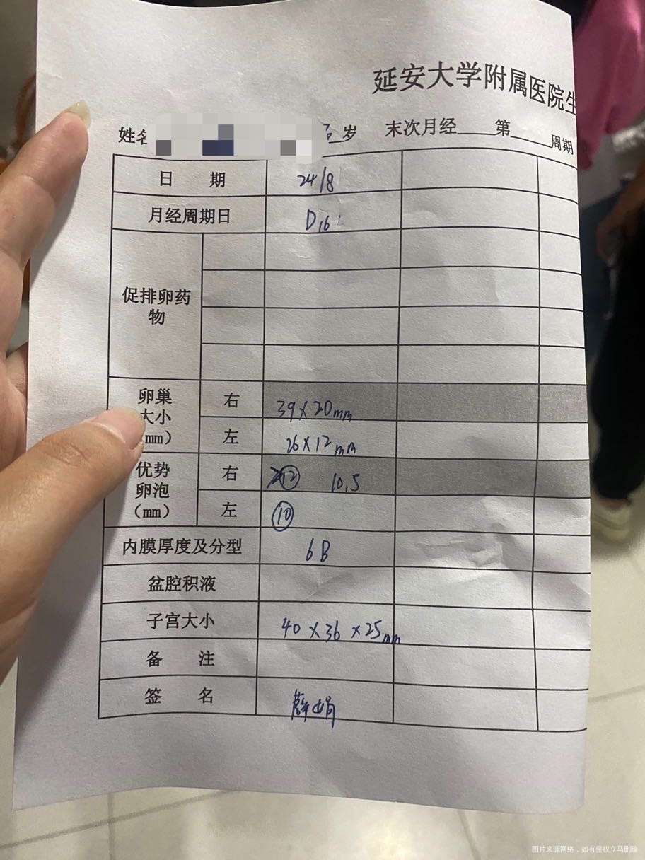 小卵泡多有没有优势卵泡发育是不是有点太慢