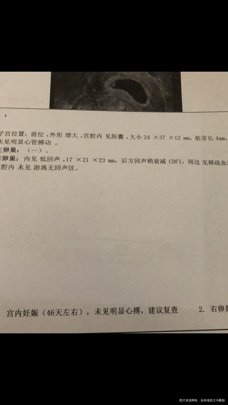 您好医生8/11日孕46天今天b超显示有4m
